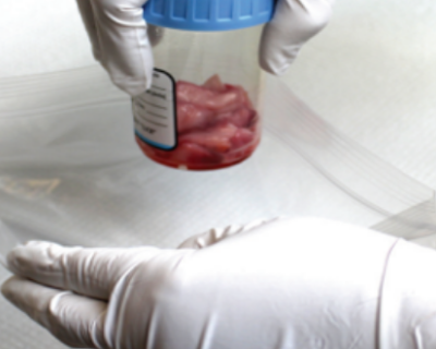 Photo of a lab cup with specimen getting bagged